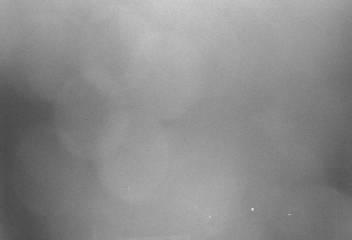 Webcam Puerto de Navacerrada: Zona Baja: Pista El telegrafo