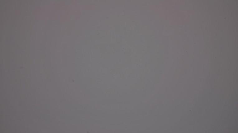 Webcam Whistler Blackcomb: Whistler Peak