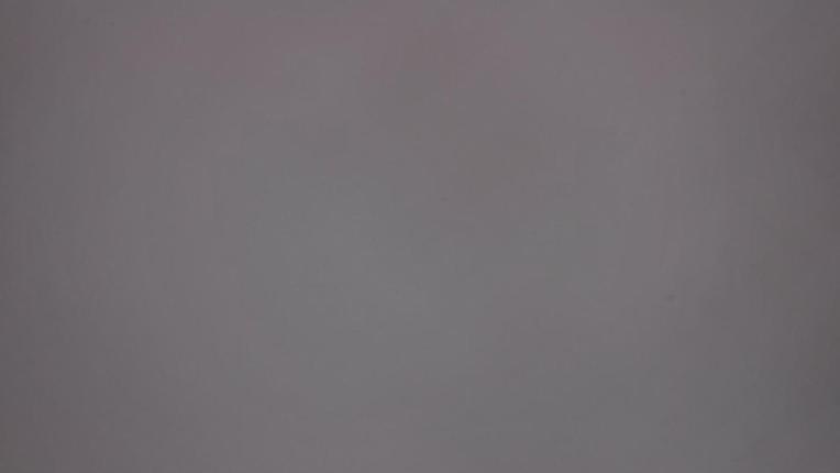Webcam Whistler Blackcomb: Whistler Peak